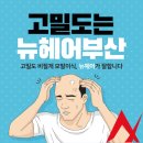 모발이식 후 개구리알이 생기는 이유