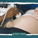 임신출산하면 노화속도 빨라진다는 얘기에 맘시들 왜 버튼 눌리는거지? 이미지