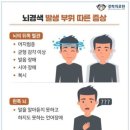 인디각건축디자인 | 뇌경색 수술 후 복시 안경 제작｜자이스 단초점 인디비주얼 1.67 프리즘렌즈 후기
