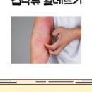 키토산 및 갑각류 알레르기 (게, 새우) 이미지