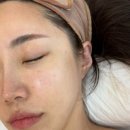 수앤뷰티피부관리 네이버블로그