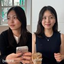 안산피부과 턱선라인케어 미글로우리프팅 후기