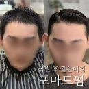삭발 후 2-3cm 짧은 남자머리, 쌍가마까지 잡은 남자 포마드펌 후기