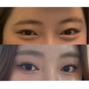 호호톡스 | [DITOX] 내돈내산 붓기영양제 효과 본 후기(Feat.다이톡스 리베인 정)