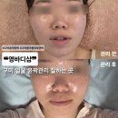 영바디샵