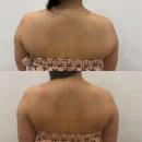 끌리네 | 전주 효자동 바디관리 끌리네피부관리 등관리 후기