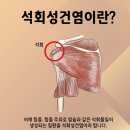 아이앤아이 이미지