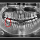 찬치과기공소 이미지