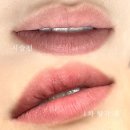 입술문신 탈각 후기 많은 곳💋