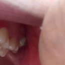 헤르만의정원in강릉 | 정원이의 2025년 이모저모