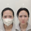 뚱이헤어 - 달서구 | 군자 헤어라인 정리 처음해본 후기! 진작할걸.. by 조이로운