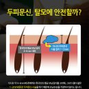 두피문신 후기!