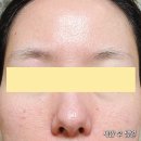 주식회사 큰나무약품 | 메디힐 마데카소사이드 에센셜 마스크팩 정보: 흔적 리페어 SOS? (제품 정보, 솔직 후기)