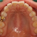 보강치과기공소 이미지