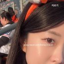 트리플2 | 압구정 피부과 피코트리플 2주 변화 피코토닝 상세 후기