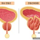 광생약국 네이버블로그