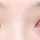 아이율