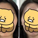 아름 한의원 | 아름턱한의원 60회 후기