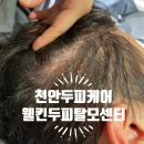 웰킨두피탈모센터천안신불당점 | 천안 두피케어 웰킨두피탈모센터 천안불당점, 30대 남자 두피 열감 붉어짐 후기