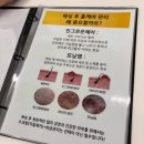 은비약국 | 노원 브라질리언 슈가링 하드왁싱 더라인왁싱