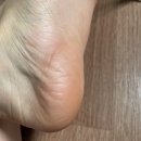 세린플래닝
