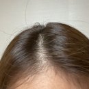 [리뷰] 테라픽 프리미엄 토탈 헤어토닉, 조세호 헤어토닉 사용 후기