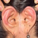 광주014 | ▶ 약사님 반신반의했는데, 몸이 좋아졌어요 - 간질성방광염인데 통증도 헉! ( 130화 )