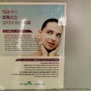 굿윌압구정약국 | [미용시술] 압구정 연세이원유치과의원 #압구정시술잘하는곳 #윤곽브이라인메조주사후기