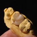 보람치과기공소 이미지