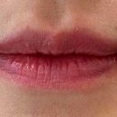 뷰티바성형외과의원 이미지