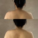 승모근웨딩케어 받고 온 후기 뷰티라보앤유 뒷태여신 등림프 관리