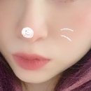 기미치료가기전 팁!!!