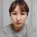 선일약국 | [수술후기1탄]눈밑 지방재배치 수술후기 수술비용Ⅰ 내돈내산(?)원정 수술 : 1일차(수술당일)