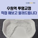수원선치과의원 | 수원역투명교정 직접 해보니 알게 된 주의사항