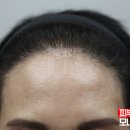 여성헤어 이미지