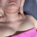 수앤뷰티피부관리 네이버블로그