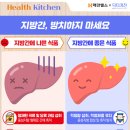 지방간의 진단과 관리 이미지