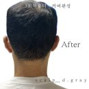스칼프 디. 그레이(Scalp-d.gray)