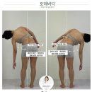 이혜진한의원 | [포레바디] 울산 바디퍼스트 10년간 약으로 버틴 두통해결 자필 후기