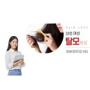 남성 탈모 여성 탈모 특징, 남성형 탈모와 여성형 탈모 과정 및 진행 속도 차이