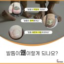 레푸스MS 이미지