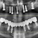 훈 기공소 이미지