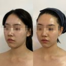 투유피부관리 | 천안 웨딩관리 추천｜본식 전 찐막관리로 선택한 뷰티투유 에스테틱