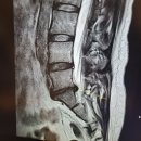 강남대로 505 고도일병원 앞 횡단보도 | 고도일병원 교통사고 허리 척추 디스크치료 후기