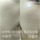 차앤박 CNP 밀크토닝필: 홈케어 밀크토닝필로 우유광채피부만들기