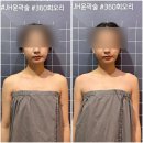 완산-32 | [전주] 전주 완산구 에스테틱 윤슬테라피, 자극없는 JH윤곽술 후기