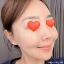 루미나에스테틱 이미지