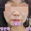 좋은두피 풀림