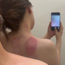 상무지구 웨딩관리 미엘멜로우 바디관리 팔뚝관리 후기