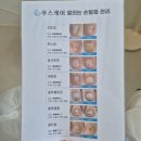 [평택] 발관리 끝판왕! 푸스케어 평택고덕점에서 내성발톱 드라마틱한 효과 보고 왔어요~